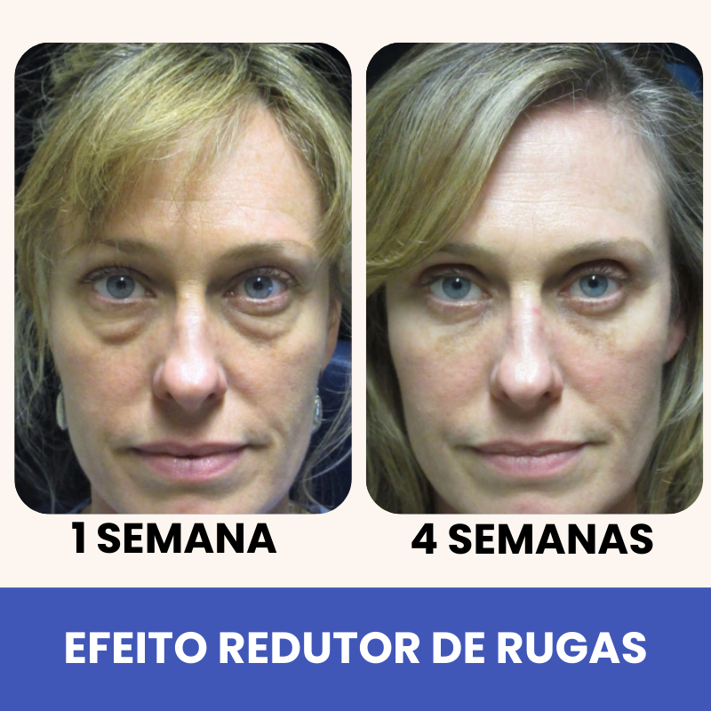 Eleva 10 em 1 - 20 Anos Mais Jovem