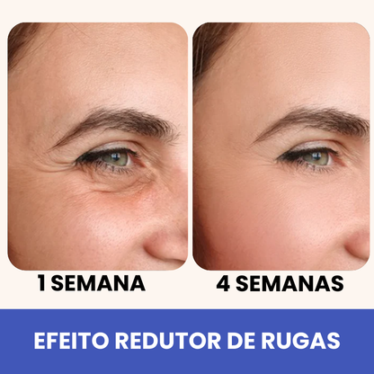 Eleva 10 em 1 - 15 Anos Mais Jovem