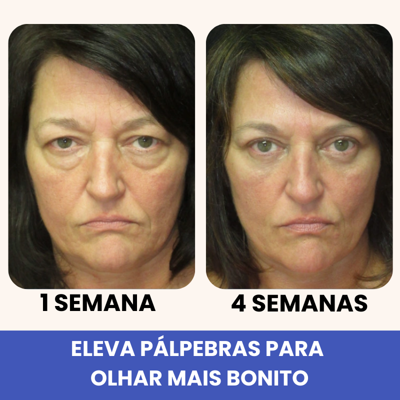 Eleva 10 em 1 - 20 Anos Mais Jovem