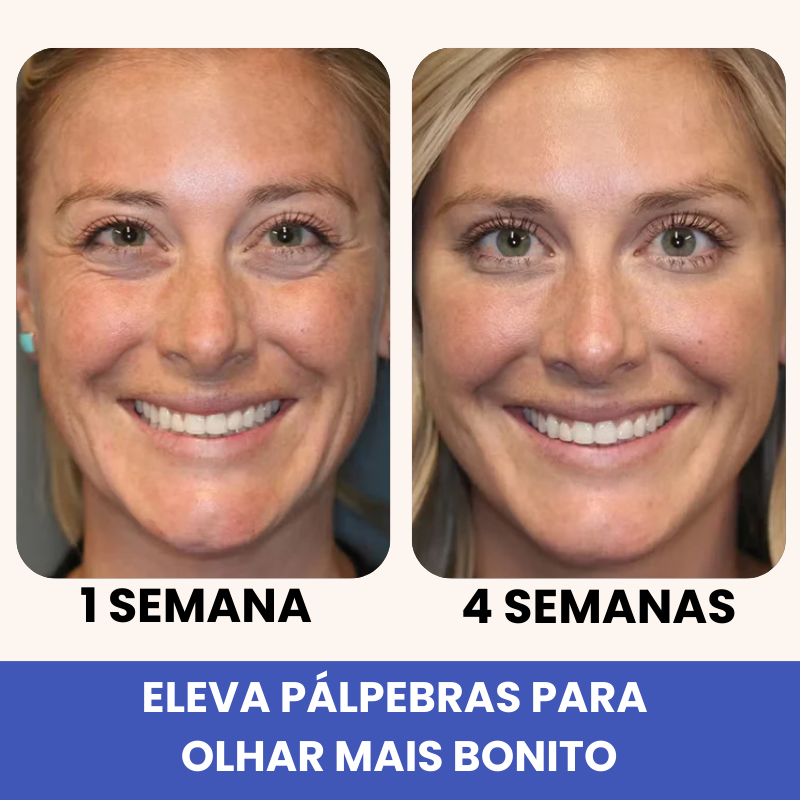 Eleva 10 em 1 - 15 Anos Mais Jovem