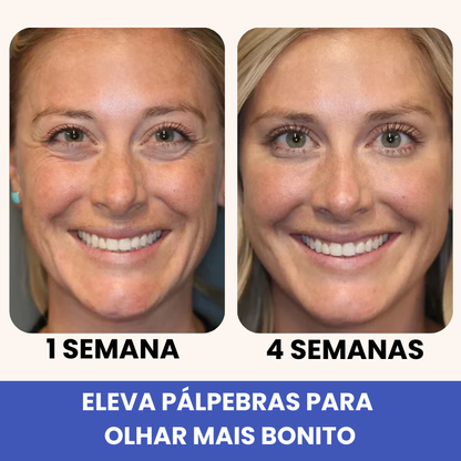 Eleva 10 em 1 - 15 Anos Mais Jovem