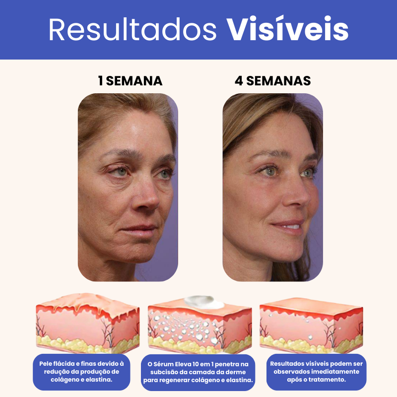Eleva 10 em 1 - 20 Anos Mais Jovem