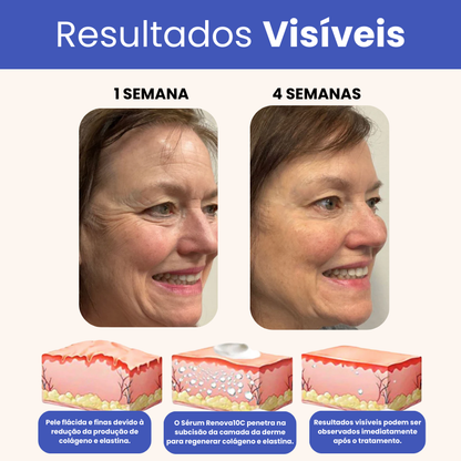 Eleva 10 em 1 - 15 Anos Mais Jovem