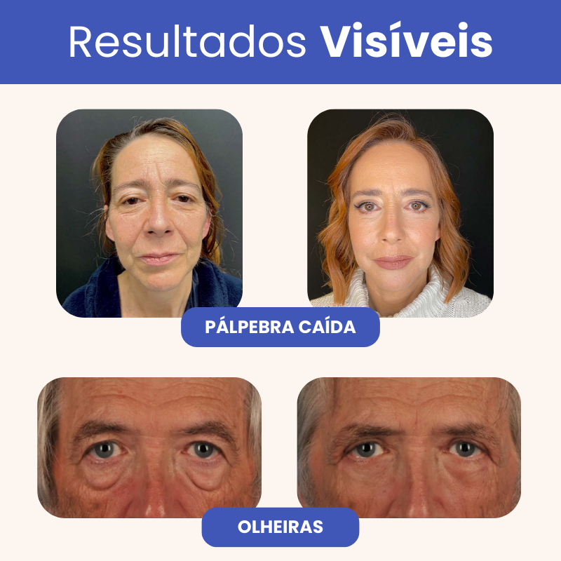 Eleva 10 em 1 - 20 Anos Mais Jovem