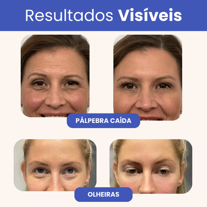 Eleva 10 em 1 - 15 Anos Mais Jovem